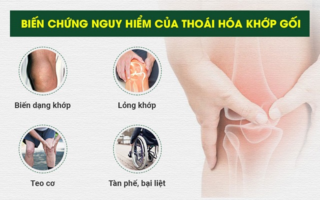 giải thuật hóa khớp gối tại nhà